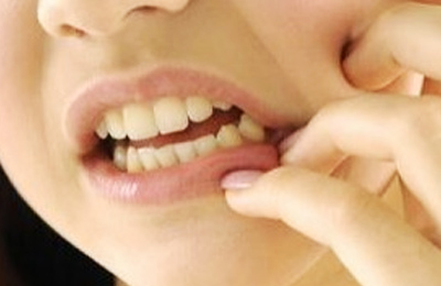 突發(fā)性、自發(fā)性的劇烈牙疼