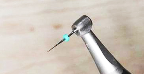 精細切割，極大程度保留牙神經(jīng)，根管治療成功率極高