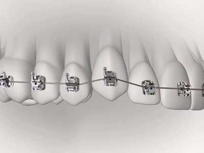 承德市哪家口腔醫(yī)院口腔正畸做得好？惟德口腔醫(yī)院來告訴您