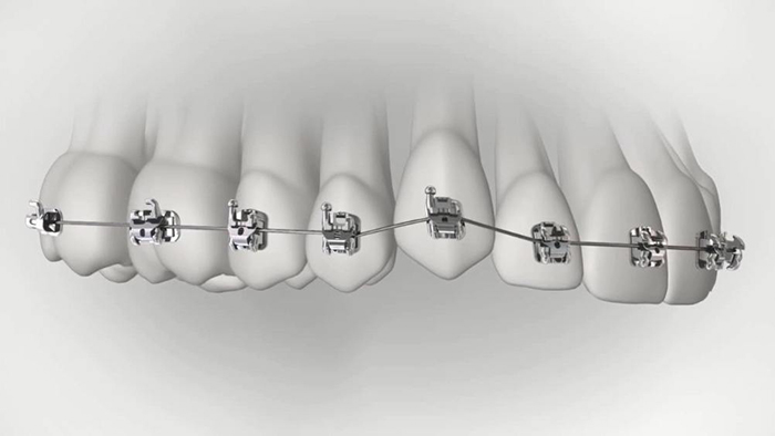承德市哪家口腔醫(yī)院口腔正畸做得好？惟德口腔醫(yī)院來(lái)告訴您