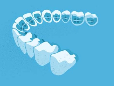 惟德口腔醫(yī)院口腔正畸好不好？